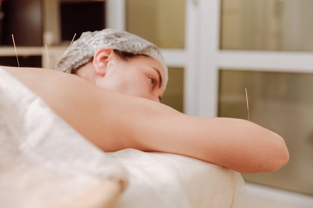 Exploring Alternative Therapies: My Experience with Acupuncture, Yoga, and More